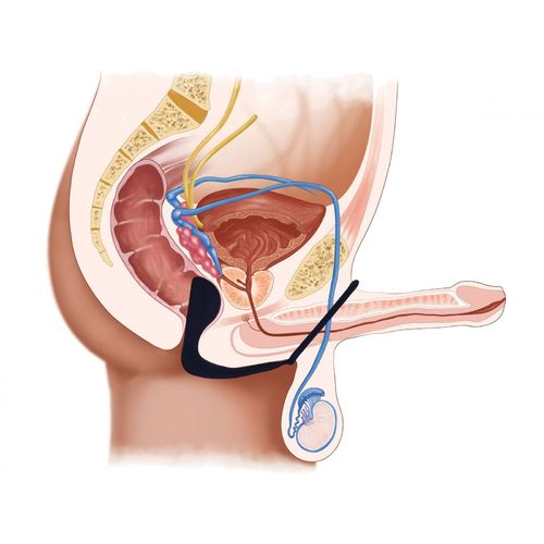 Stimulátor prostaty pro pány s kroužkem na penis